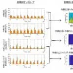 自立歩行が困難な脳卒中者の歩行回復の特徴　畿央大学が調査