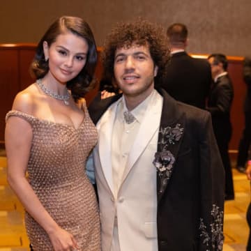 セレーナ・ゴメス、ベニー・ブランコとの初キスで湿疹！？