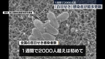 【速報】百日せき感染者数2176人　週に2000人超えは初　過去最多更新