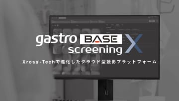 【新製品】AIメディカルサービス、対策型胃がん検診および対策型肺がん検診において医師および運用上の負担を軽減するクラウド型読影プラットフォームの製造販売認証を取得