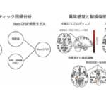 脳卒中後疼痛の病態特性　畿央大学などがサブタイプ別に包括的分析