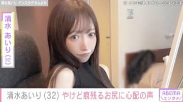 グラビアアイドル・清水あいり（32）、お尻のやけどを報告「かなり痛そうやけど大丈夫なんですか？」心配の声