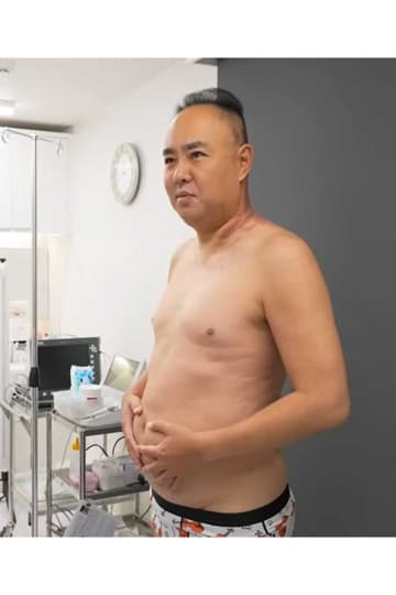 「めちゃ痩せてる！」ネット騒然　美容外科院長が話題のマンジャロ＆運動で激変