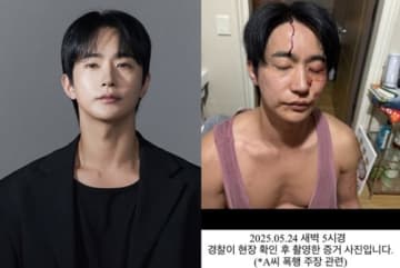 「性病をうつされ暴力もあった」と告発された韓国俳優が反論「彼女に殴られた」