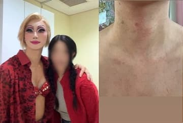 「性病うつされた」「結婚をエサに100万円奪われた」韓国ミュージカルスターに突如浮上した衝撃スキャンダル