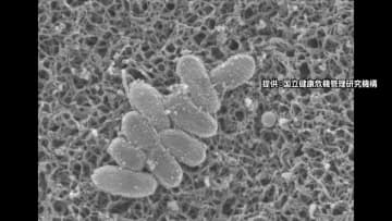 「百日咳」新規感染者数が過去最多…1週間で2299人感染　「リンゴ病」新規感染者数も過去10年で最多に