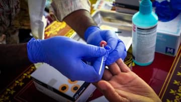 バングラデシュ：ロヒンギャ難民キャンプでＣ型肝炎が蔓延──国境なき医師団が3万人治療へ大規模キャンペーン開始