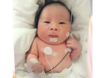妊婦健診で「足が短いな･･･」と言われ、出産後に10万人に1人のまれな骨の病気が判明。治療法がなく完治する病気ではないと知り･･･【体験談】