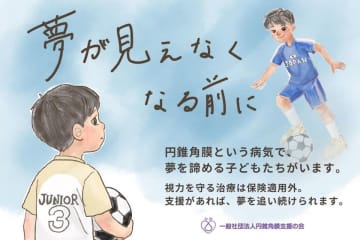 円錐角膜の子供への角膜クロスリンキング費用を支援　5月12日から7月31日までクラウドファンディングを実施　～未成年の円錐角膜に対する角膜クロスリンキング費用を支援したい～