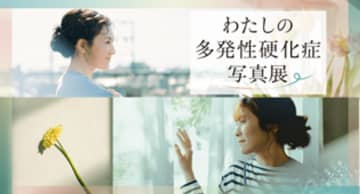 5月30日はWorld MS Day　「Moments of Smile：フォトグラファー・国分真央が映した多発性硬化症」の本編を公開　～多発性硬化症(MS)とともに、自分らしく生きる方々を映し出す～