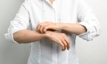 『蚊に刺されやすい人』の特徴3選　刺されないための対策は？