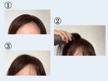 【画像ギャラリー】薄毛でもトップをふんわり仕上げる方法は