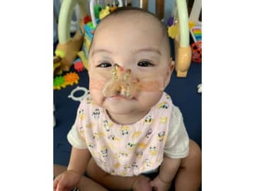 「このお口、見れなくなるの少し寂しい」。口唇口蓋裂の子を育てる母の想いと治療とは？～新生児医療の現場から～【新生児科医・豊島勝昭】