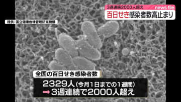 【速報】百日せき、全国の感染者数2329人で前週比減少も高止まり続く　年間累計2万5000人超え過去最多