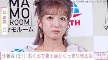 第5子妊娠中・辻希美「ずっと靴下はいてるのもキツい」むくみで悩む足の写真を公開