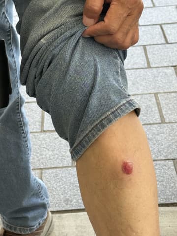 ロスでデモ隊と州兵衝突取材の新華社カメラマン負傷