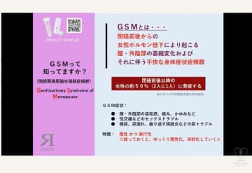 フェムゾーンのかゆみ、痛み、尿もれ…「GSMかも？」 若年層にも増えている婦人科系の病気。予防や治療法はあるの？