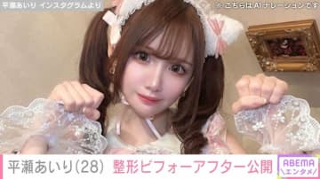 整形総額2600万円超・平瀬あいり（28）、学生時代から現在までのビフォーアフター公開「これからも努力惜しまない」