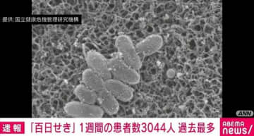 「百日せき」1週間の患者数3044人 過去最多に
