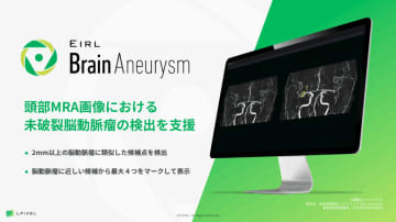 頭部MRA画像から脳動脈瘤候補点を検出するEIRL Brain Aneurysm偽陽性の低減を実現した新モデルを発売