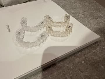 元あいのりメンバー、3週間インビザラインを続けて気付いたこと「こんなに色が変わってた」