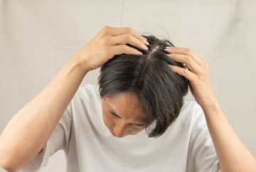 髪が抜けるのはストレスのせい？医師に聞いた「自律神経と抜け毛」の関係性
