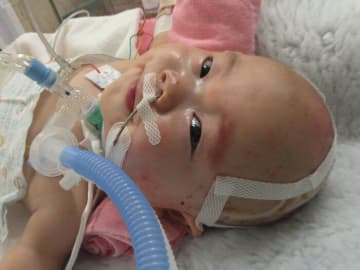 664gで生まれ､NICUに600日間入院した息子は2歳に｡「モニターじゃなくて赤ちゃんの表情を見て」という看護師の言葉に励まされながら･･･【体験談】