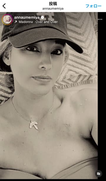 「これが、今の私」梅宮アンナ(52)、乳がん手術後の“ありのままの水着姿”を初公開。その“潔い美しさ”に称賛の嵐