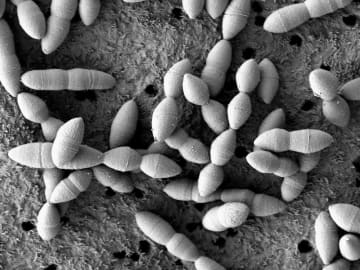 がん攻撃力高める腸内細菌　「免疫療法」に効果か