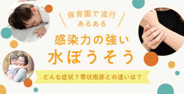 【保育園で流行あるある】感染力の強い水ぼうそう、どんな症状？帯状疱疹との違いは？