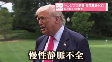 トランプ大統領「慢性静脈不全」足にむくみで検査　どんな病気なのか