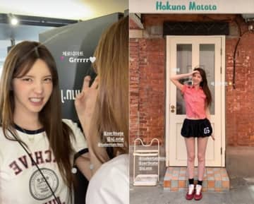 “パク・ソジュンとの熱愛説”で一躍時の人に、韓国美女ユーチューバーが流行りの歯科施術を報告