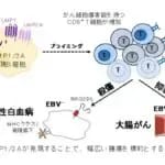 子どもの頃に感染するEBウイルスによりがんに対する免疫が向上　広島大学が発見