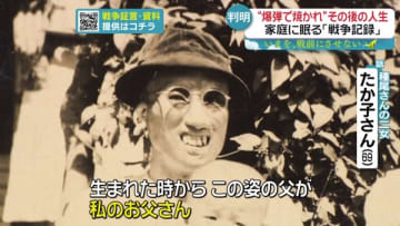 「耳も鼻もなく、口も裂け」　焼夷弾で焼かれた“ハンサムな兵隊さん”　その後の人生は？　戦後80年…子の思い