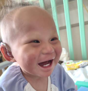 「これ以上、娘の自由を奪わないで！」皮膚の疾患、難聴、角膜炎･･･病気がわかるたびに打ちのめされた【KID症候群・体験談】