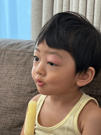 おばたのお兄さん、２歳息子のまぶた腫れた「犯人は蚊」