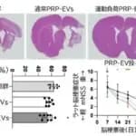 慢性期脳梗塞　運動後の多血小板血漿が回復を促進　順天堂大学が発見