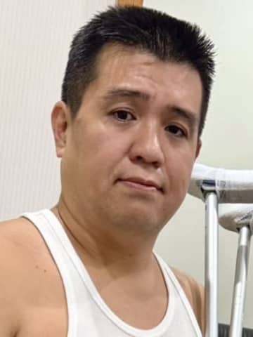 ジェラードン・アタック西本「迷惑かけます！」　ネタ中に肉離れ