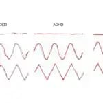 ADHDなど神経発達症特性ごとに異なる子どもの「書きにくさ」　畿央大学が研究