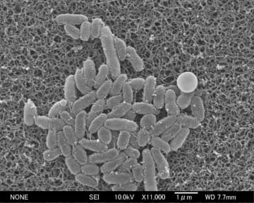 百日ぜき患者数、初の7万人超　前週から減も依然高水準