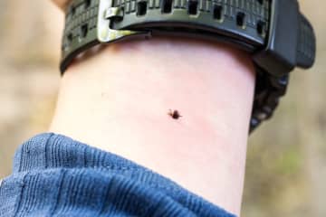 致死率は10～30％、全国に拡大…“マダニ感染症”の「簡単な見分け方」と身を守る服装