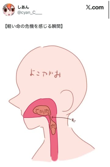 【軽い命の危機を感じる瞬間】誰もが経験する？肉が喉に詰まった状態を描いたイラストに「牛丼でよく起きる」と共感の声
