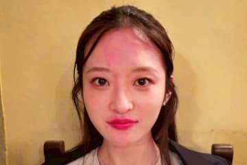 【閲覧注意】1杯で顔真っ赤、話題のミス東大タレントが「遺伝子検査したら…」　アレルギーは反応出ず