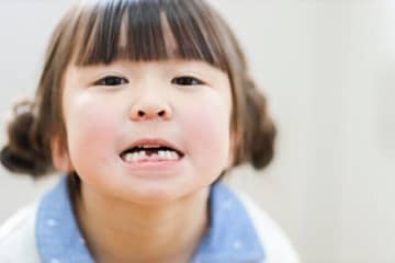 子どもの歯並びをよくするのは矯正一択ではない！乳幼児期から始める、いい歯並びのための新習慣【小児歯科医】
