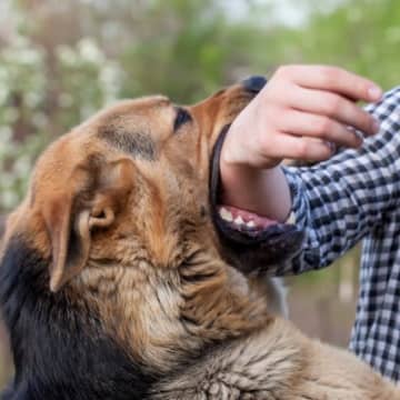 犬が『飼い主に噛みつく』理由5選　噛むようになってしまう要因や逆効果となるしつけの仕方まで