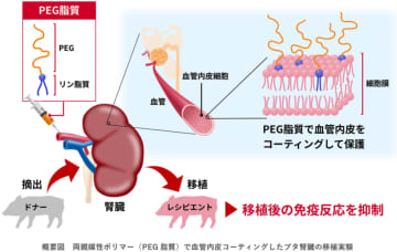 両親媒性ポリマーで血管内皮をコーティングし免疫反応を抑制