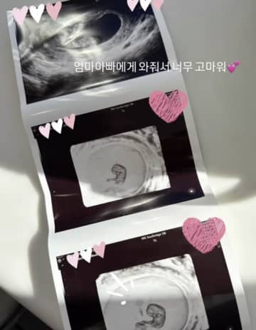 “2度の流産”乗り越えて、ようやく…第二子妊娠を発表、韓国出身モデルのヘリム・パク（40）