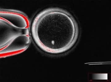 ヒトの皮膚細胞から卵子を作製、不妊治療に新たな扉