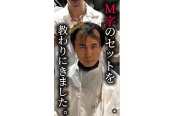 「M字ハゲ」を子どもの保育園面接の前になんとかしたい　薄毛に悩むパパが驚きの変身　「すごい若返っている！」