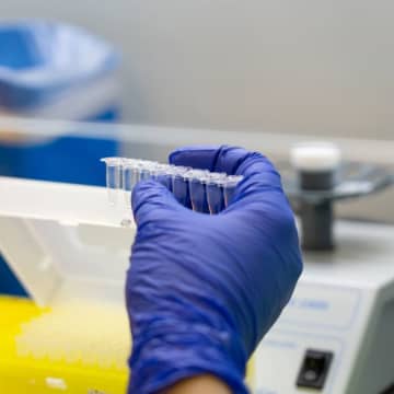 5年生存率8.5%の膵臓がんは診断後すぐに「遺伝子パネル検査」を実施すべき
